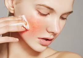 Damaged Skin Barrier: How to Repair It Naturally for Sensitive Skin