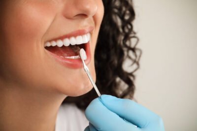 Ceramic Crown Benefits Uses and Is It Right for You